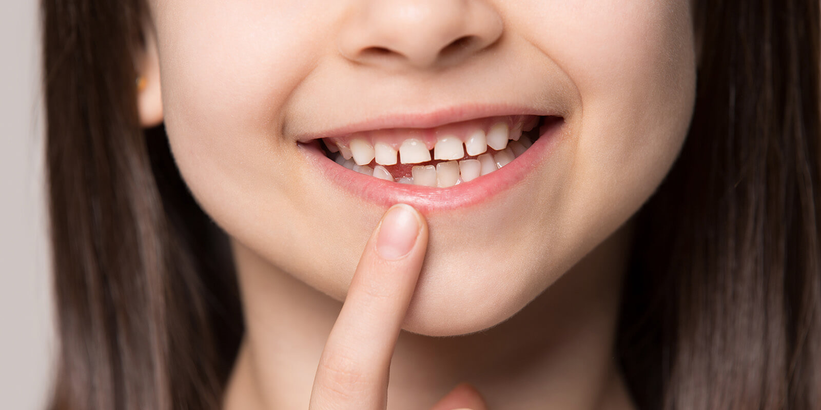 当院の小児矯正について