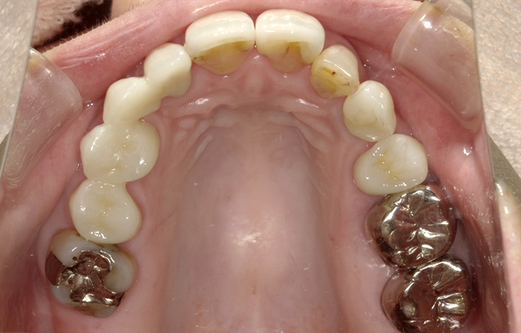 審美治療の症例写真