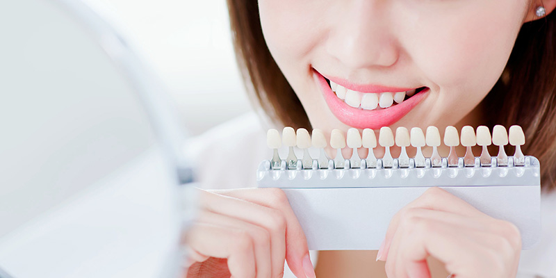 ホワイトニングとは